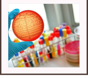 オイズ（OIZ）PBジェルの全額返金保証制度の利用の方法